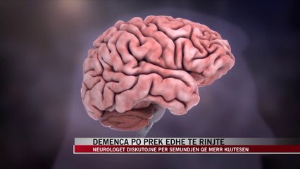 "Sëmundja e kujtesës" po prek edhe moshat e reja në Shqipëri - News, Lajme - Vizion Plus