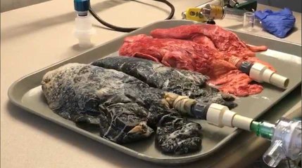 La vidéo choc qui va vous faire arrêter de fumer