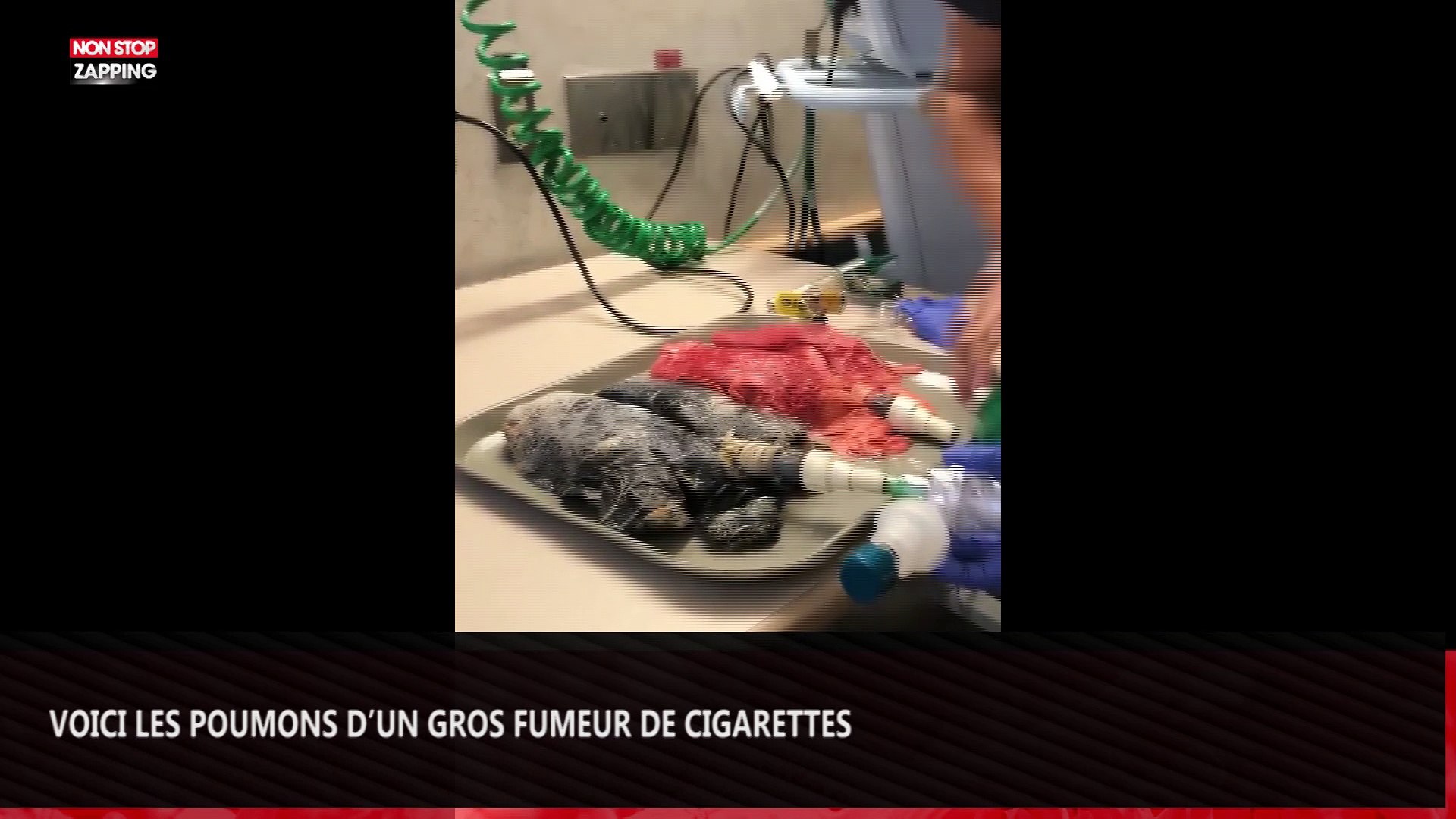 Voici Les Poumons D Un Individu Qui A Fume Cigarettes Par Jour Pendant Ans Video Choc Video Dailymotion