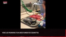 Voici les poumons d’un individu qui a fumé 20 cigarettes par jour pendant 20 ans (Vidéo choc)