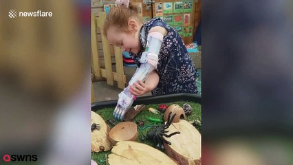 Sweet girl playing with her new ‘Frozen’-themed prosthetic arm will warm your heart