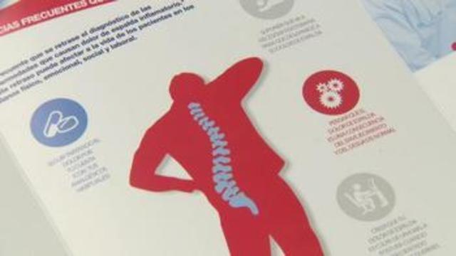 Uveítis, psoriasis y digestivo, patologías vinculadas a la espondilitis