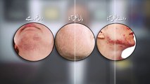 Top 3 Side effects of whitening beauty creams by Skin Specialist Dr Muhammad Iqbal _ Urdu Hindi