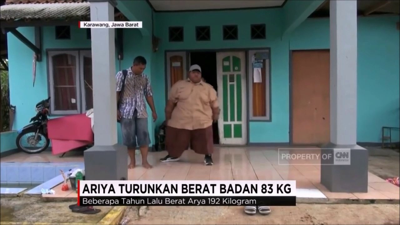 L'ado le plus gros du monde à perdu 83kg soit la moitié de son poids