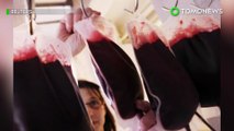 Orang dengan golongan darah O berisiko meninggal karena luka serius - TomoNews