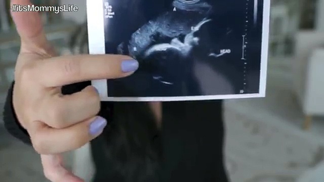 36 Weeks Pregnant with Twins! (FINAL UPDATE!) - itsMommysLife