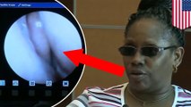 Woman’s runny nose is actually leaking brain fluid - TomoNews