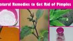 पिंपल दूर करने के 5 चमत्कारिक उपाय -5 Home Remedies To Get Rid of Pimples Naturally And Permanently