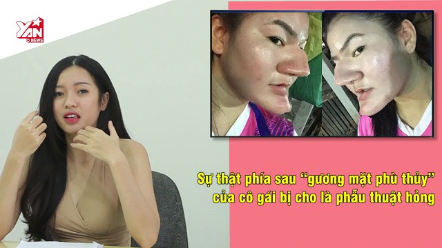 Sự thật phía sau “gương mặt phù thủy” của cô gái bị cho là phẫu thuật hỏng