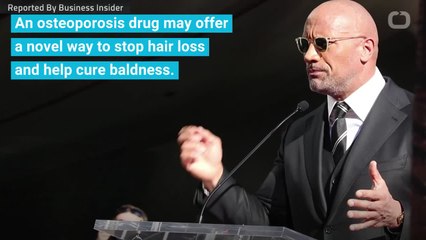 Bone Strengthening Medicine Has Exciting Off-Label Use: Treating Hair Loss