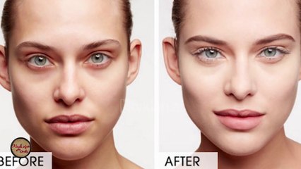 Kush vjen per dreke/ Recetat qe iu ndihmojne te zbardhni rrathet e zinj poshte syve (13.02.2018)