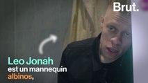 Leo Jonah, mannequin albinos