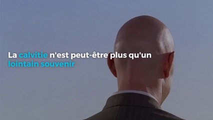 La calvitie n'est peut-être plus qu'un lointain souvenir