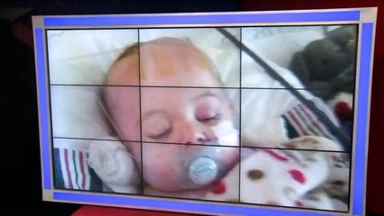 Baby Faces Long Road to Recovery After Falling Off Bed