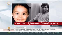 DNA testi için doku örneği alındı