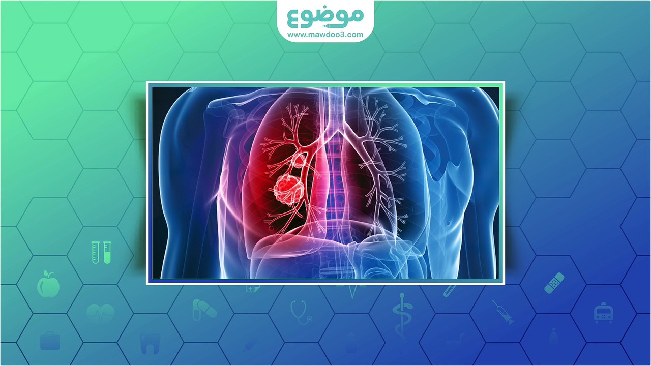 كيف تعرف أنك مصاب بالسرطان
