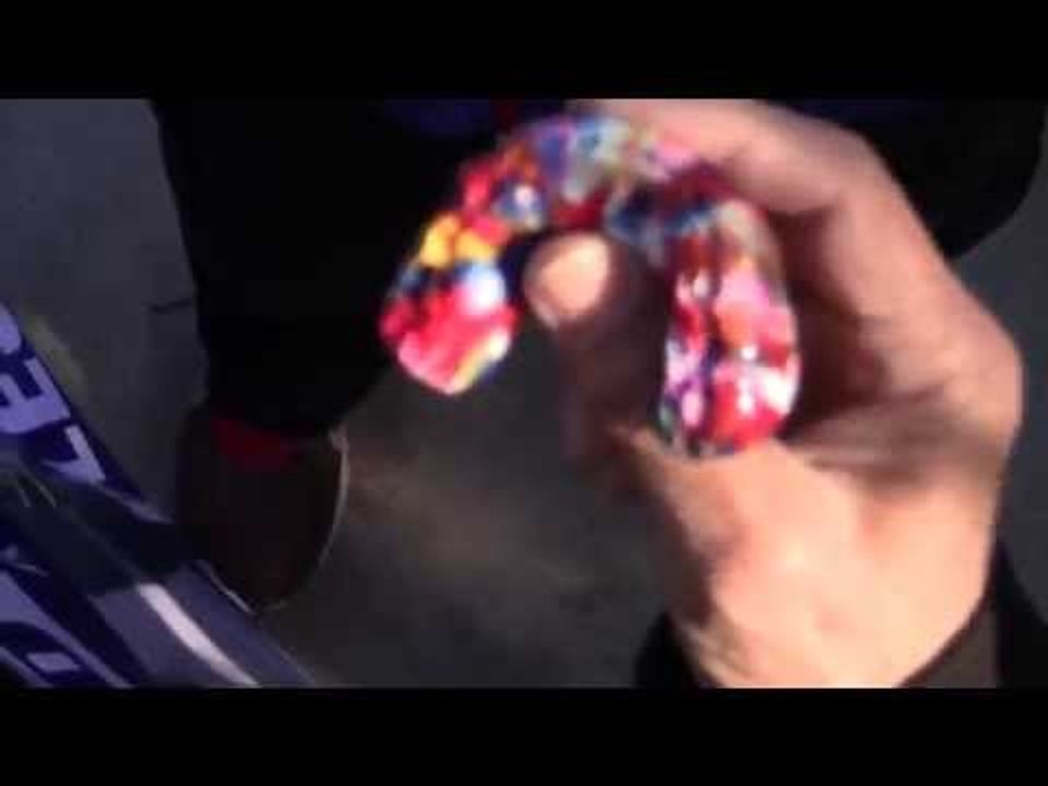 MANNY PACQUIAO: Breakdown Of Mouthpiece Design & True Cost for Floyd Mayweather vs Manny Pacquiao