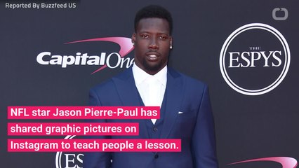 NFL Star Jason Pierre-Paul Reminds People Fireworks Are Dangerous