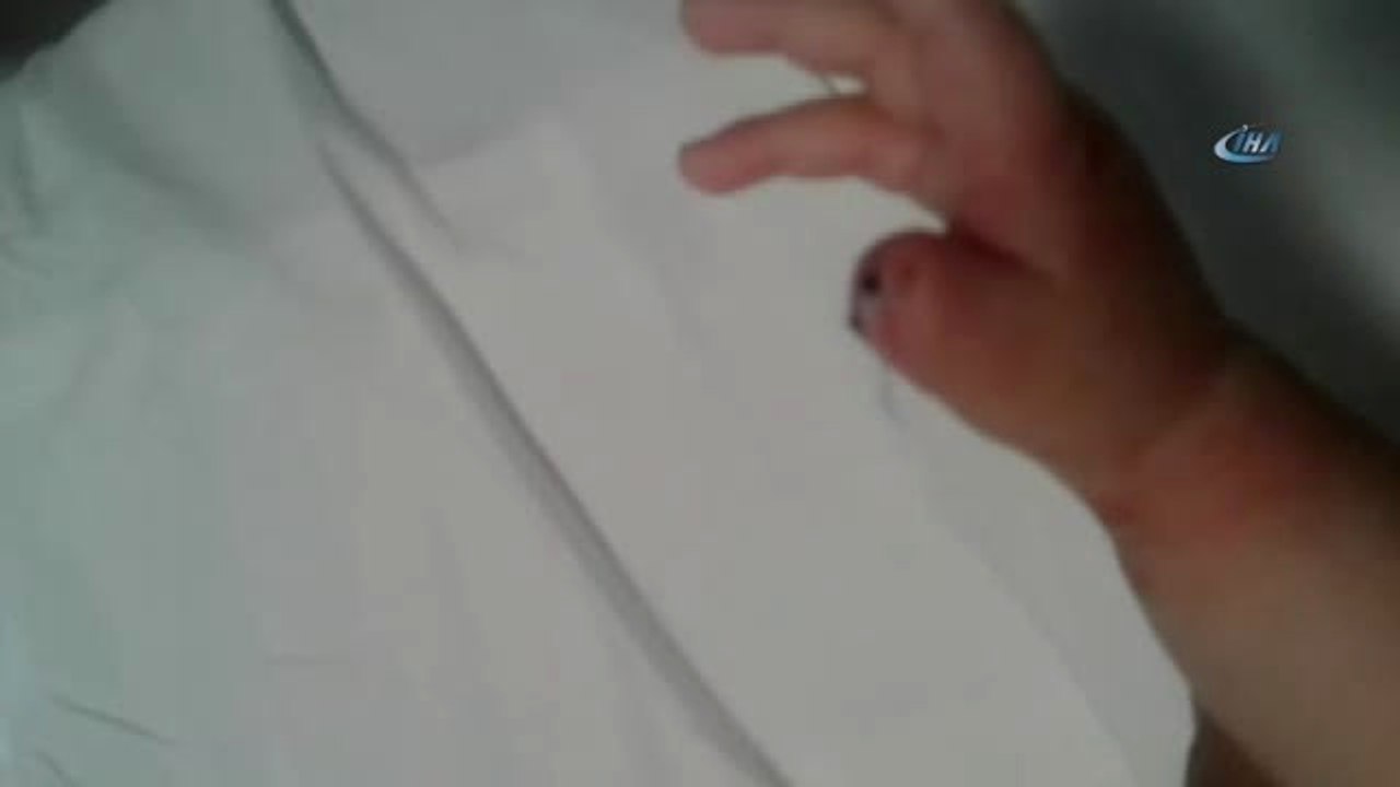 Sağlık Personeli 1,5 Aylık Bebeğin Parmağını Kesti