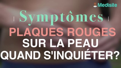 Plaques rouges sur la peau : quand s’inquiéter ?