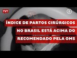 Índice de partos cirúrgicos no Brasil está acima do recomendado pela OMS