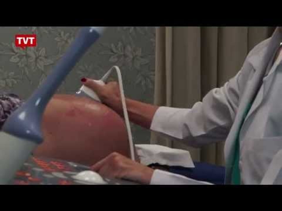 Novas regras para reduzir número de cesáreas em planos de saúde