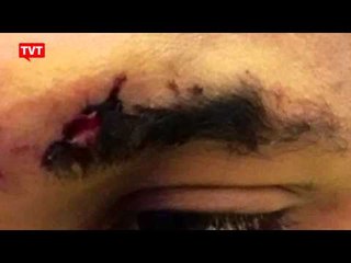 MP denuncia mais dois casos de tortura na Fundação Casa