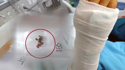 총기사고 부상 장병 아버지 "정확한 진상 조사 필요" / YTN