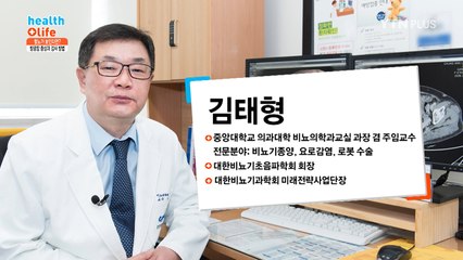 연성 방광 내시경을 통한 방광암 검사 알아보기 / YTN