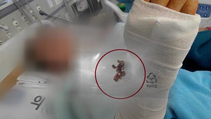 총기사고 부상 장병 아버지 "정확한 진상 조사 필요" / YTN