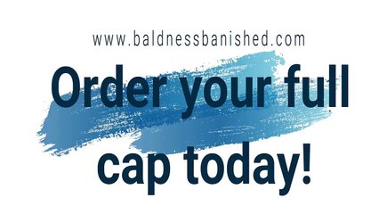 Non surgical full cap hair replacement from www.baldnessbanished.com - 13.5.18