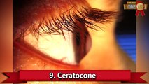 Top 10 Doenças Mais Raras e Brutais dos Olhos