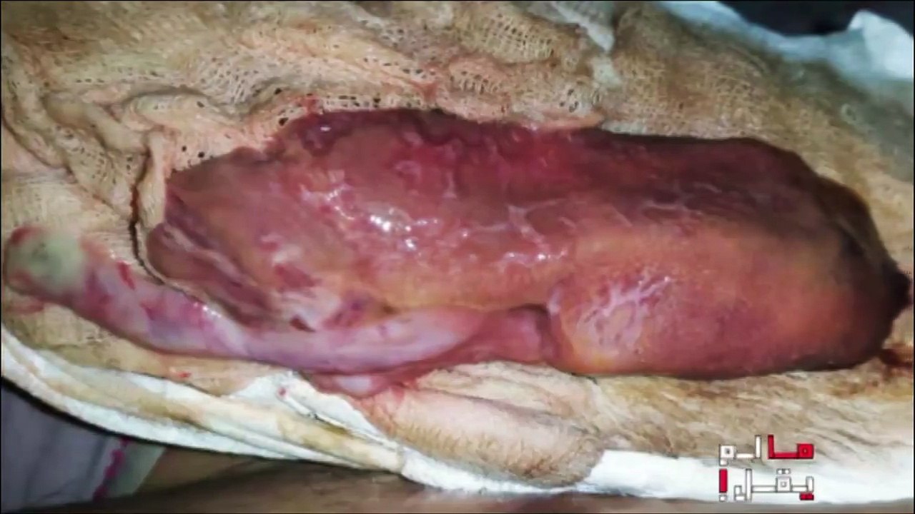 عطست خرجت كلوتها؟؟ وين وصلت حكايتها؟البث المباشر : https://elhiwarettounsi.com/live.html#ما_لم_يقل►Retrouvez vos programmes préférés : https://goo.gl/gxtCTu