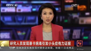 [中国新闻]研究人员发现寨卡病毒引发小头症有力证据