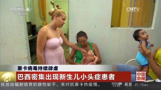[中国新闻]寨卡病毒持续肆虐 巴西密集出现新生儿小头症患者