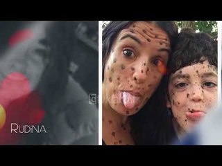 Rudina - Nishanet çfarë duhet të dimë dhe si të kujdesemi! (18 prill 2018)