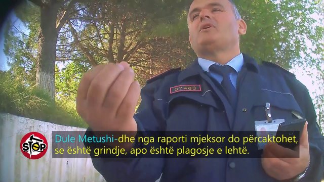 Stop - Kucovë, qytetari me plagë denoncon dhunën, autorët enden të lirë. 18 prill 2018