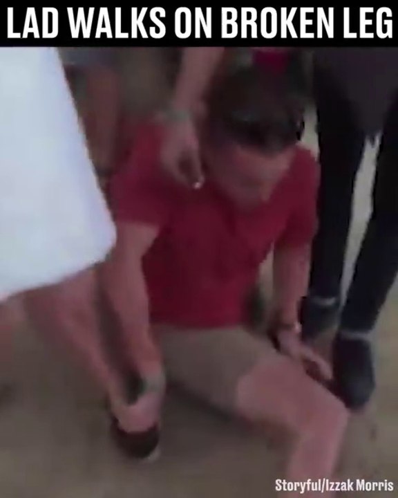 Il marche avec sa jambe cassée... Mais comment c'est possible???