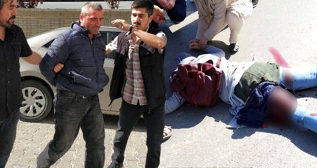 Boşanma Aşamasındaki Koca, Sokak Ortasında Baldızını Bacaklarından Vurdu