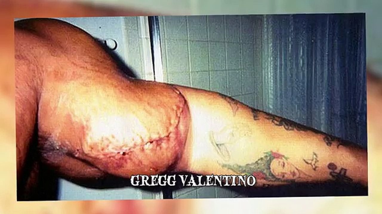 10 Bodybuilders Who Took Things Too Far