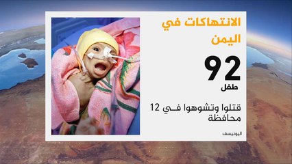 اليونيسيف: 11 مليون طفل يمني بحاجة للمساعدة