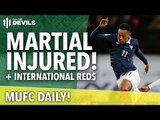 Anthony Martial Injured! | MUFC Daily | Manchester United