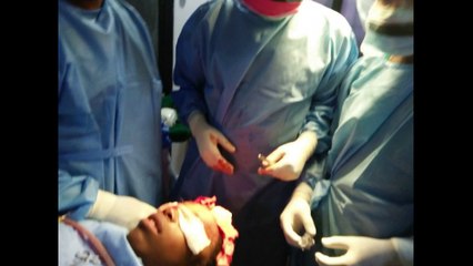 Facial Feminization Surgery Results Before After