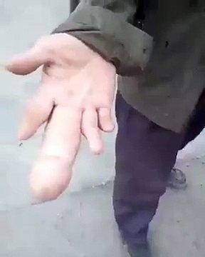 Ce gros doigt de cet homme ressemble à un pénis