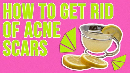 How To Get Rid Of Acne Scars