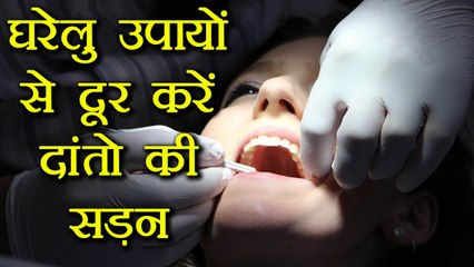 Tooth Decay: Home Remedies to stop, दांतो की हर समस्या दूर करेंगे ये आसान घरेलु उपाय | Boldsky