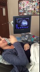 Download Video: Une mère enceinte ne croit pas ses yeux quand elle voit l'échographie