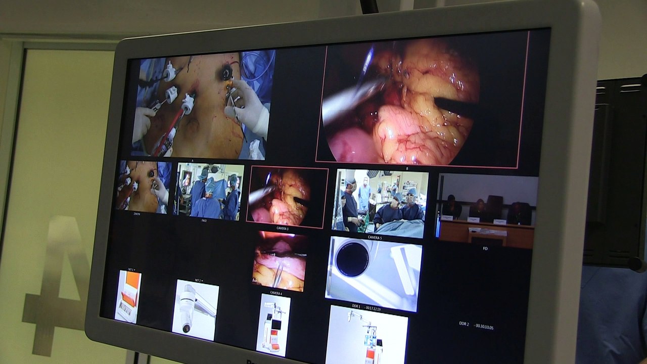 Info / Actu Loire Saint-Etienne - A la Une : C'est la journée européenne de l'obésité, une maladie qui touche 15% des adultes français. Certains ont passé le cap de l'opération chirurgicale. Témoignages.