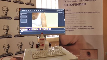 Report TV - Spitali Hygeia fushatë ndërgjegjësimi kundër kancerit të lëkurës