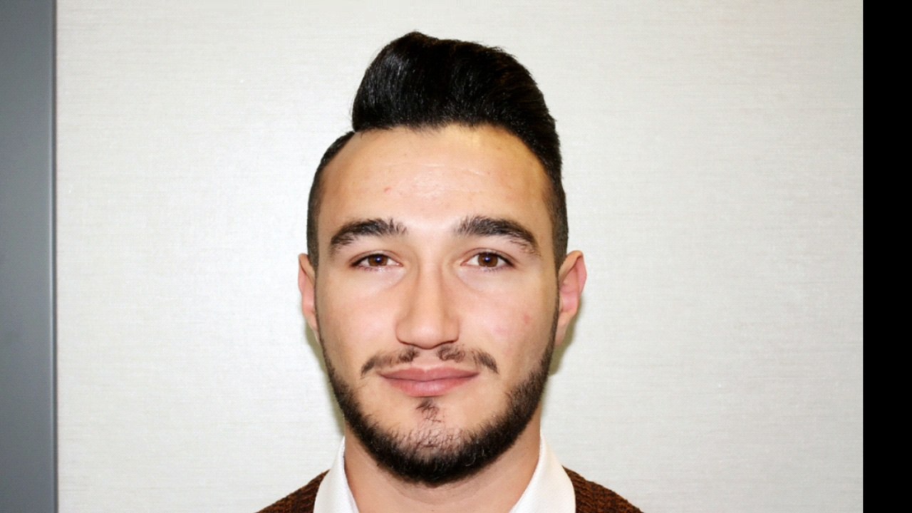 Mustafa Ali Yanık burun şikayet ve çözümleri ve hasta sonuçları